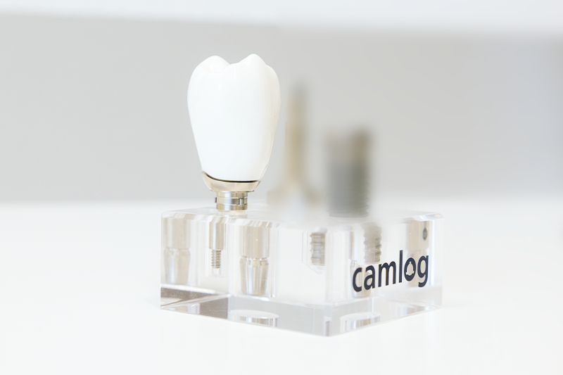 Ein Camlog Implantat.