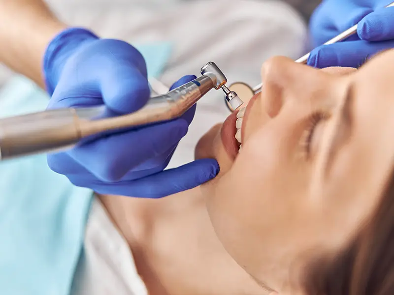 Direkte Draufsicht während eine ZFA die Zähne einer Patientin poliert.