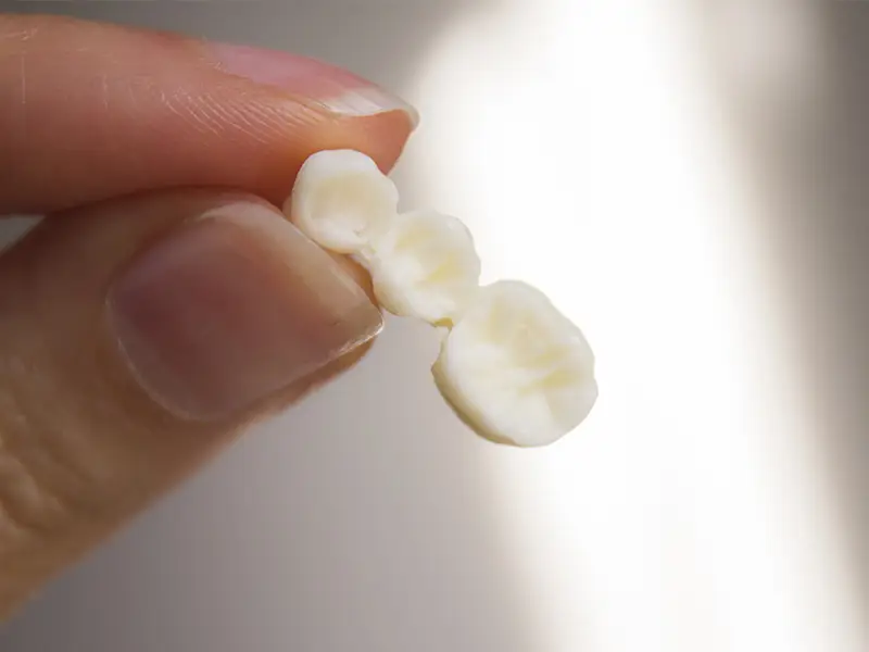 Zu sehen ist eine fertige Zahnkrone.